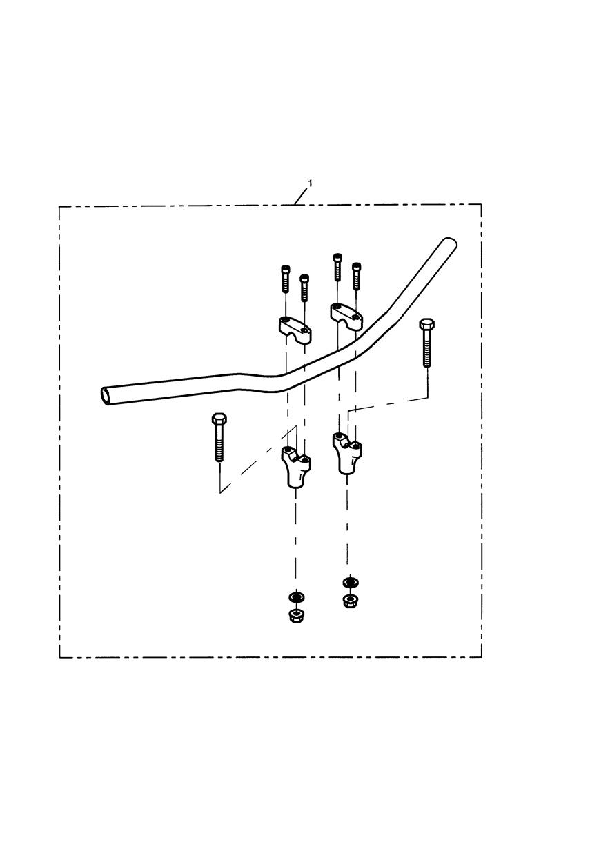 Oversize Handlebar Kit, Black exploded diagram